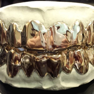 Grillz chapado en oro de plata de ley 925 real – parrillas Hip Hop de 6 8 o  dientes individuales Estilo: 6 dientes superiores