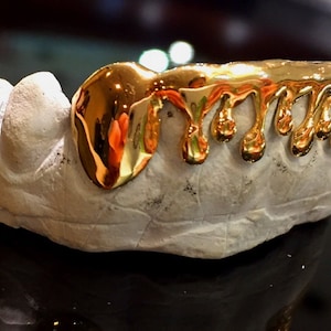 May include: Gold grill with a dripping design. The grill is made of gold and has a shiny finish. The grill is designed to fit over the upper teeth.