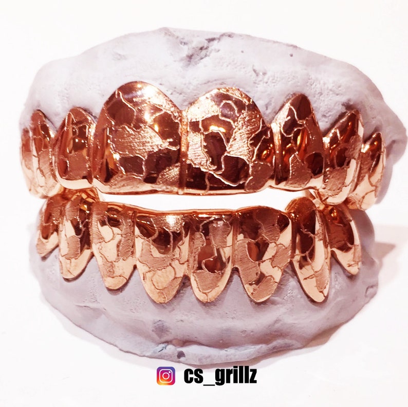 925 Sterling Silver Rose Gold Plated w/ Nugget Cut Custom Fit Handmade Real Grill Grillz image 1