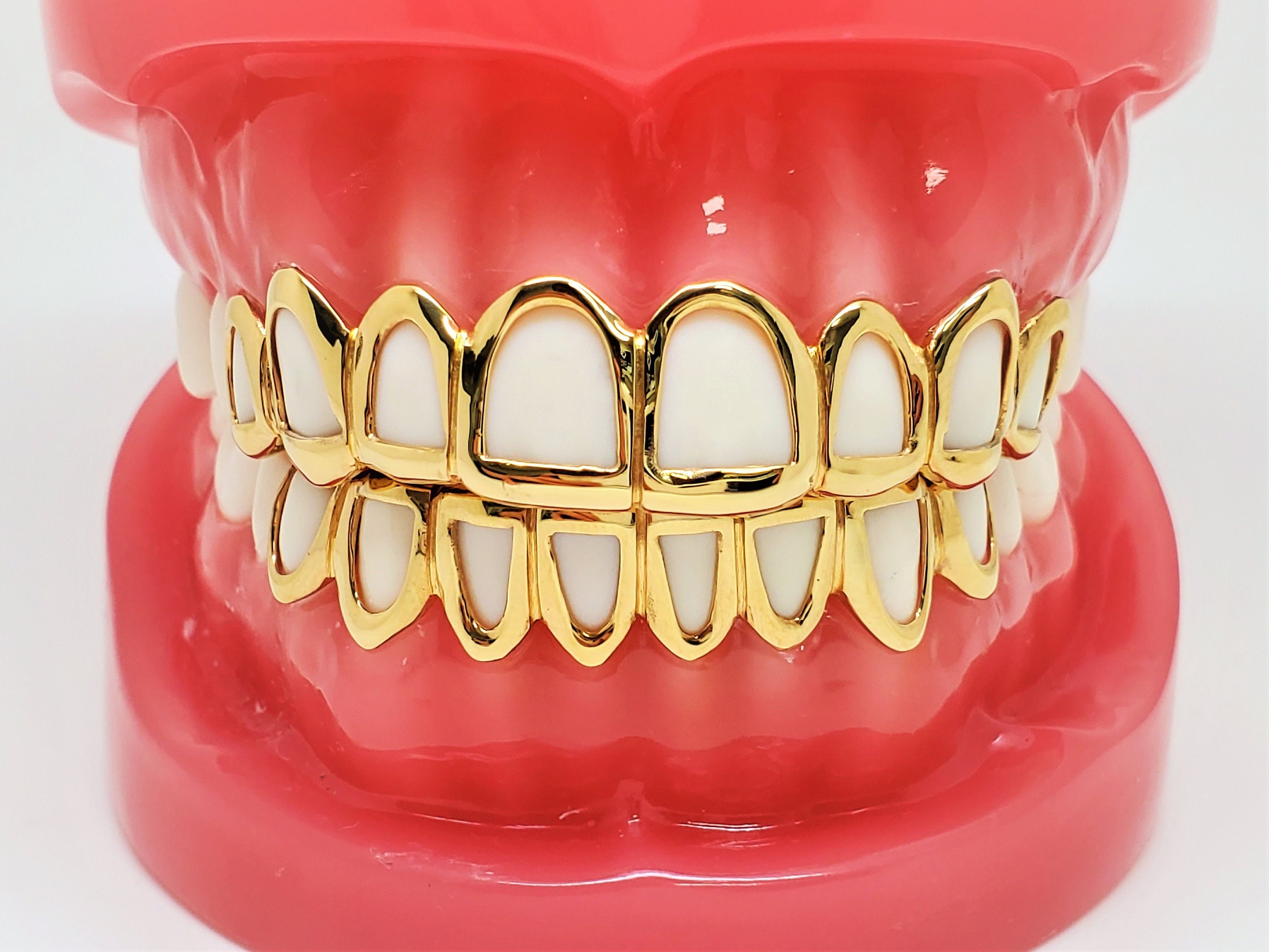 PROTEGE DENTS OPRO GOLD BRACES ROSE ADULTE - Univers Crampons