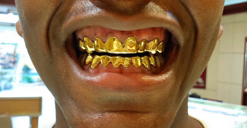 925 Sterling Silver w/ 18K Yellow Gold Plated Custom Real Handmade Grillz image 3