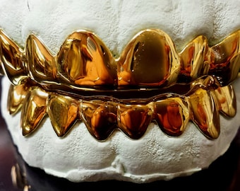 May include: Gold grill with a white mold, showing the front teeth and the back teeth. The grill is shiny and has a sharp, pointed design.