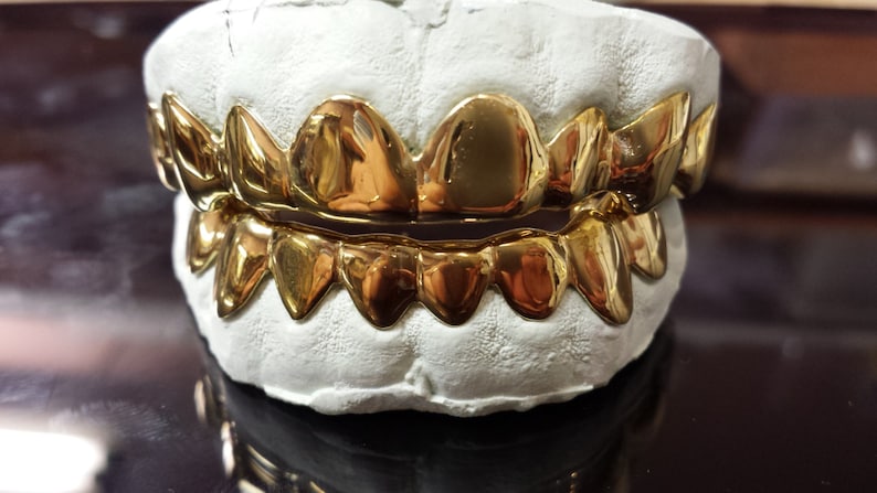 Peut inclure: Un ensemble de grillz en or, pr&eacute;sent&eacute; sur un moule dentaire blanc. Les grillz sont tr&egrave;s polis et r&eacute;fl&eacute;chissent la lumi&egrave;re, mettant en valeur leur couleur dor&eacute;e. Les dents sont dispos&eacute;es en un ensemble complet, &agrave; la fois sup&eacute;rieur et inf&eacute;rieur.