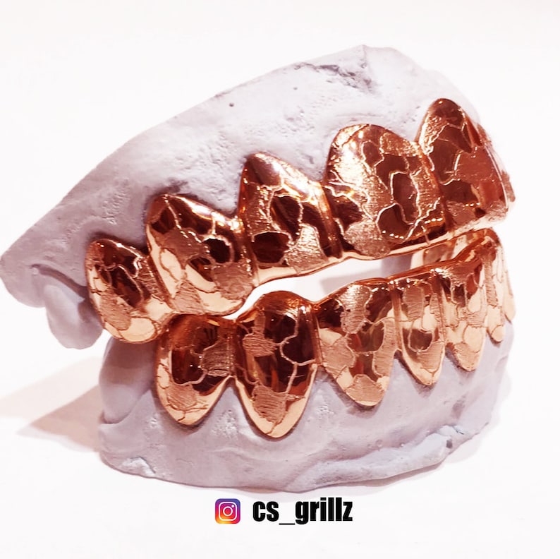 925 Sterling Silver Rose Gold Plated w/ Nugget Cut Custom Fit Handmade Real Grill Grillz image 5