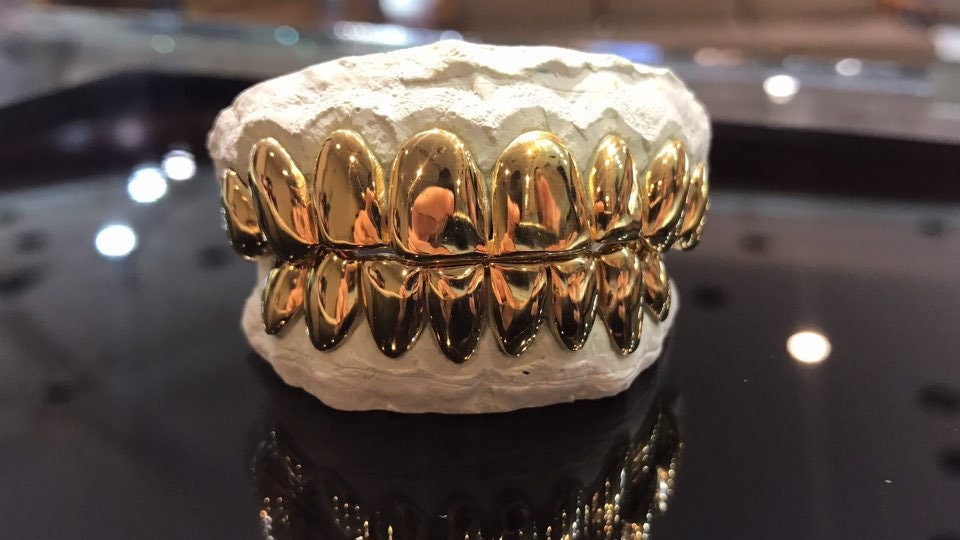 18K Solid Yellow Gold Custom fit REAL Perm Cut Grill Gold Teeth GRILLZ.