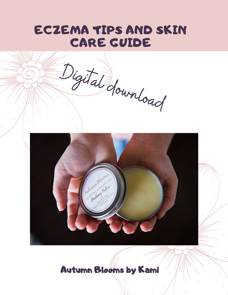 Eczema Eczema Tips and Skin Care Guide Digital Product PDF Etsy