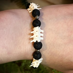 May include: A beaded bracelet featuring alternating white bone-like vertebrae segments and round, porous black lava stone beads. The design includes small, metallic silver-toned spacer beads positioned between the black stone and bone elements.