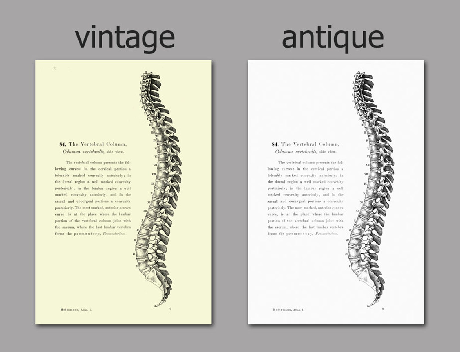 Human Anatomy Print Set of 6, Vintage Anatomy Home Decor, Antique Book ...