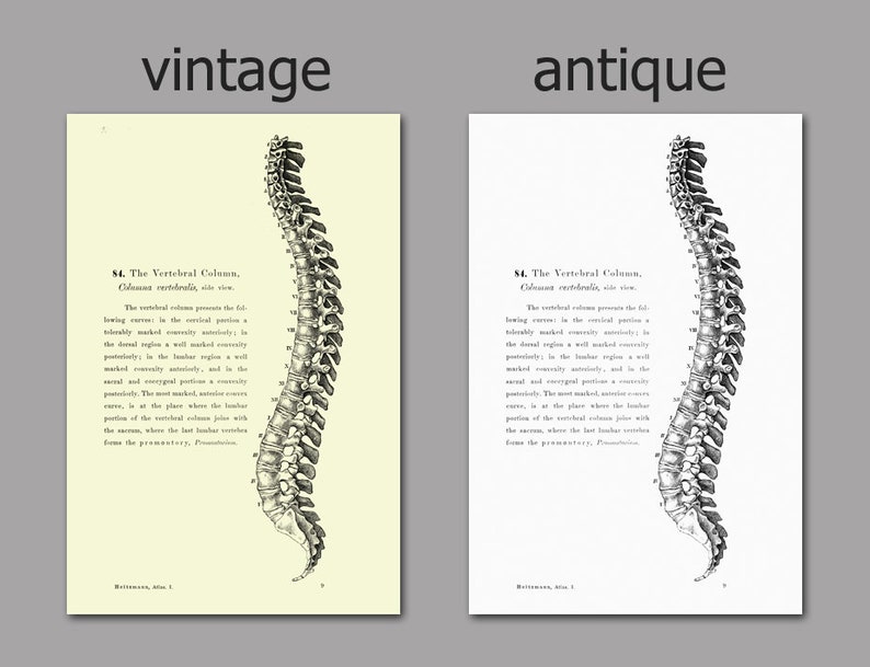 Human Anatomy Print Set of 6, Vintage Anatomy Home Decor, Antique Book ...