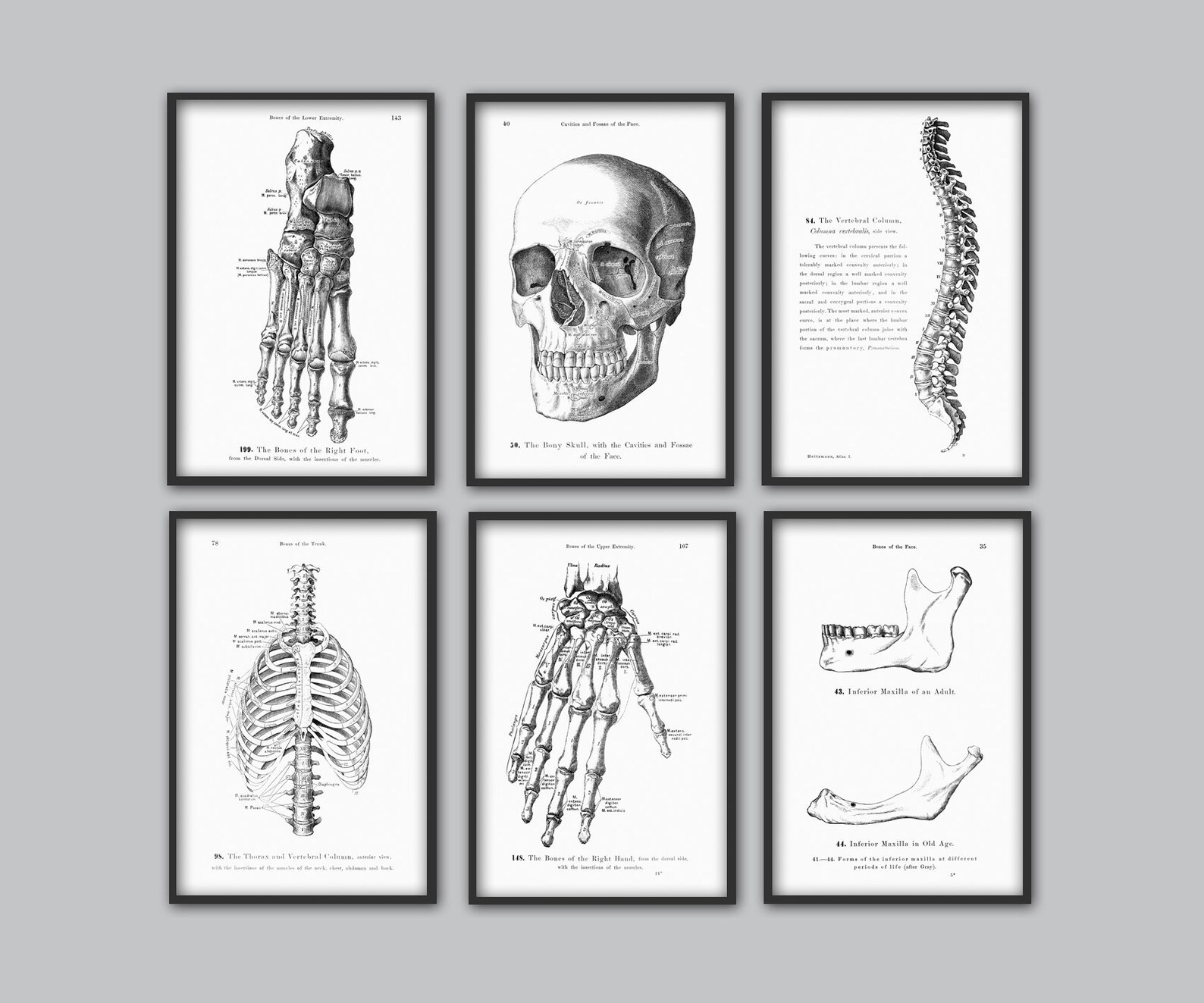Human Skeleton Bones Print Set of 6 - Human Skull Wall Art - Anatomy ...
