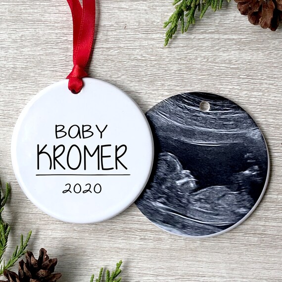 ultrasound picture ornament