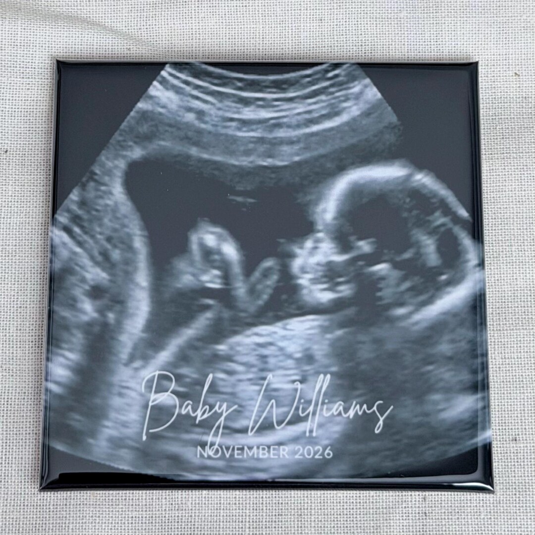Sonogram Magnets Ultrasound Keepsake Magnet | Personalized Baby Announcement | Custom ...