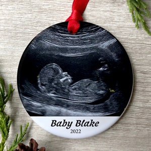 Baby Sonogram Christmas Ornament | Ultrasound Christmas Ornament | Baby's First Christmas 2022 | Pregnancy Announcement | Baby Ornament 2022