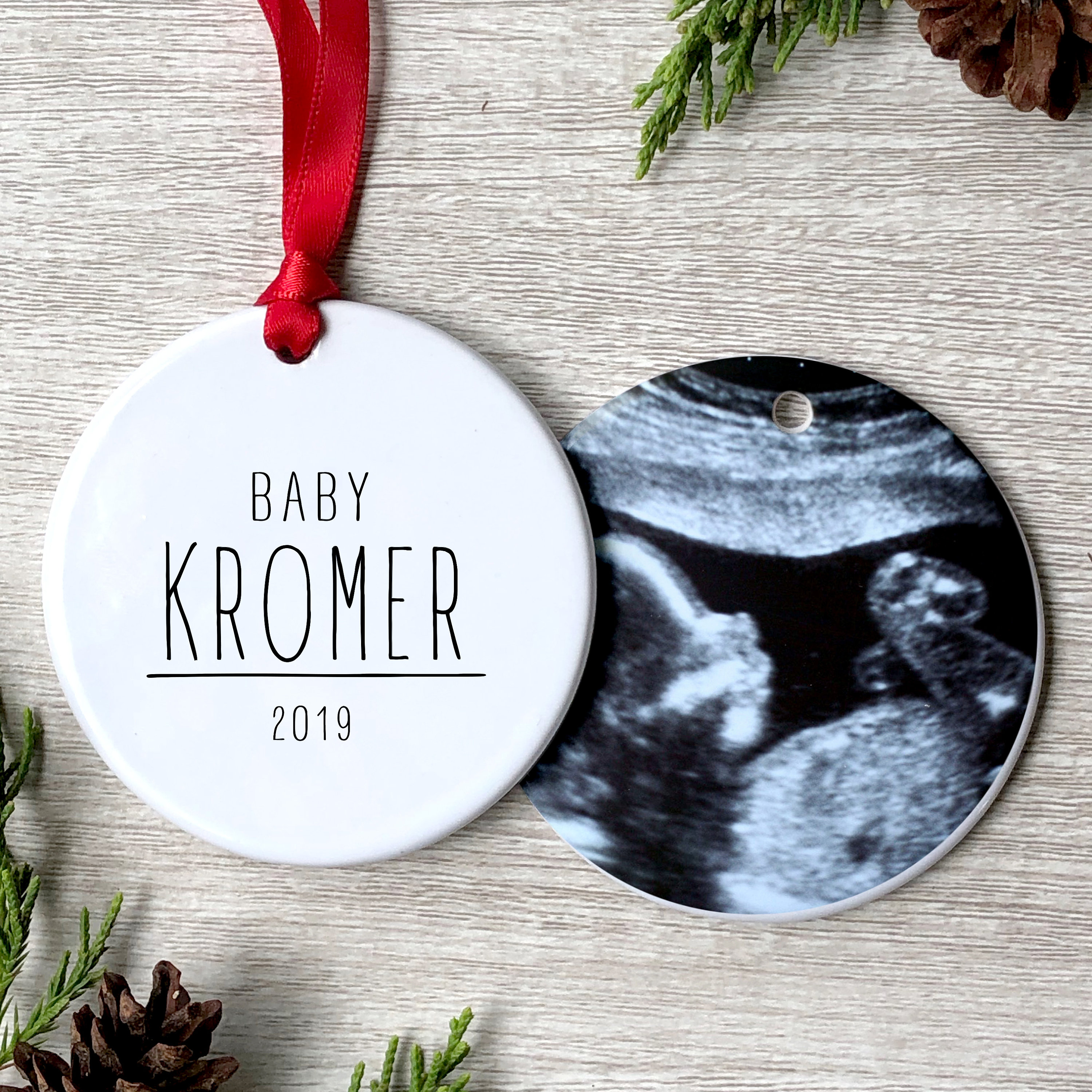Baby Sonogram Christmas Ornament Ultrasound Christmas Etsy