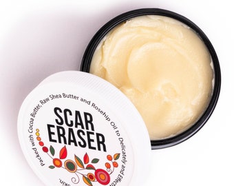 Scar Cream | Made with Natural Ingredients Can Help with Scars, Stretch Marks, Dark Spots | No Synthetics or Preservatives | Moisturizing