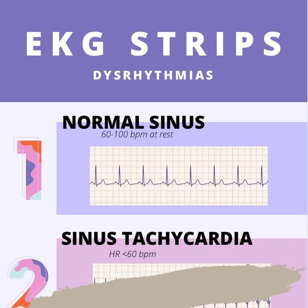 Ekg Strips - Etsy