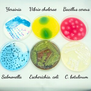 Pode incluir: Seis placas de Petri com diferentes tipos de culturas bacterianas. As culturas são etiquetadas: Yersinia, Vibrio cholerae, Bacillus cereus, Salmonella, Escherichia coli e C. botulinum.