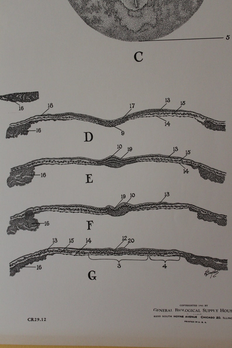 Vintage 13 and 18 Hour Chick Embryo Classroom Chart From Turtox - Etsy