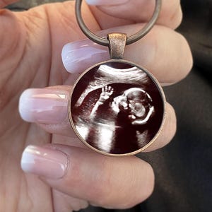 Personalized Ultrasound Photo Keychain for Dad, New Dad Gift