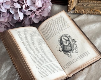 Set of 2 Antique French Leather Bound Books - 19th Century - Obstetrics History - Midwifery Gift