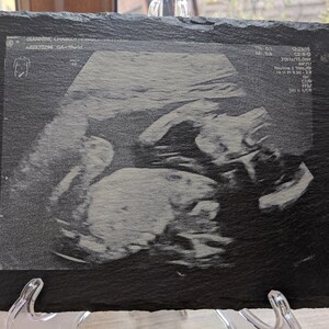 Slate baby scan photo print