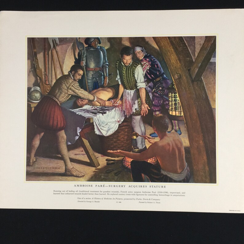 Buy Medical Print Ambroise Pare Surgery Acquires Stature History of