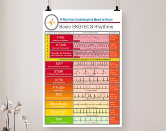 Basic EKG-ECG Rhythms Knowledge Poster/Canvas, School Room Decor Home Club Wall Decor Vintage Plaque