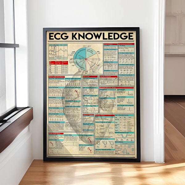 Ecg Knowledge Poster, Vintage Knowledge,  ECG Poster, Lead ECG leads Poster, Cardiologist guide Hospital Office Clinics, Medical Student