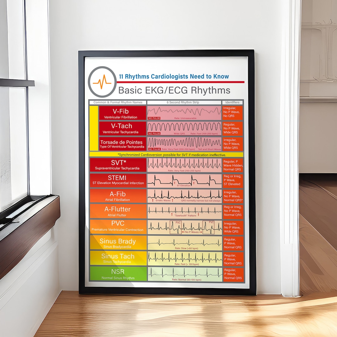 Basic EKG-ECG Rhythms Knowledge Poster/canvas, School Room Decor Home ...