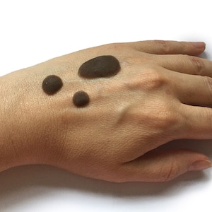 May include: A hand with three dark brown moles on the back of the hand.
