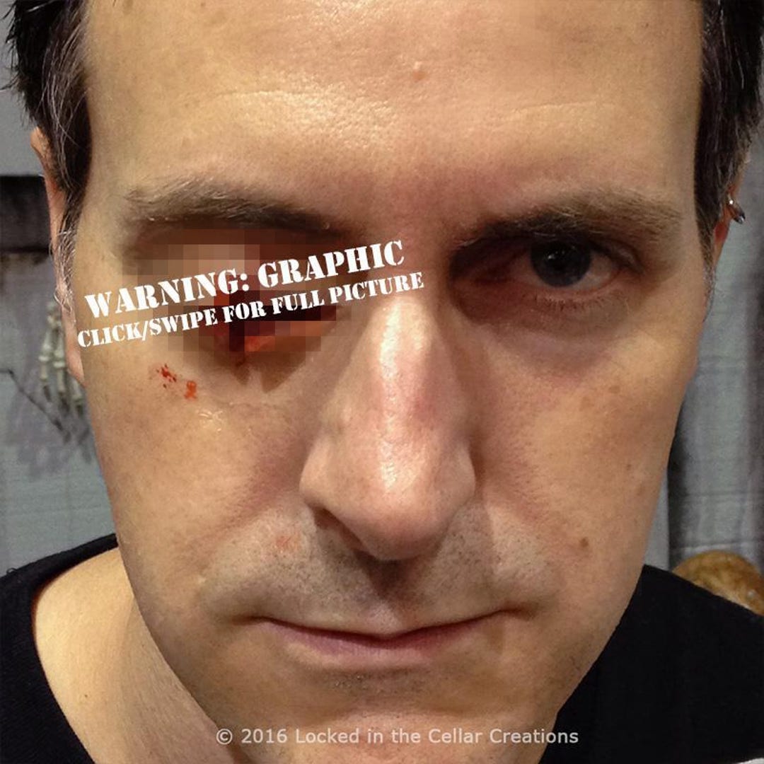 Missing Eye Prosthetic left or Right, Gouged Out Eye Injury Prosthetic, for  Halloween or Zombie Make-up or Horror Cosplay - Etsy