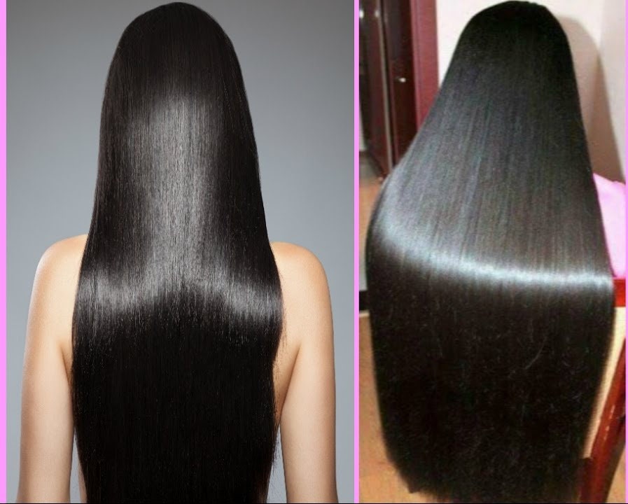 Ayurvedic Hair Loss Oil Herbal Treatment Hair Fall Dry Scalp Etsy