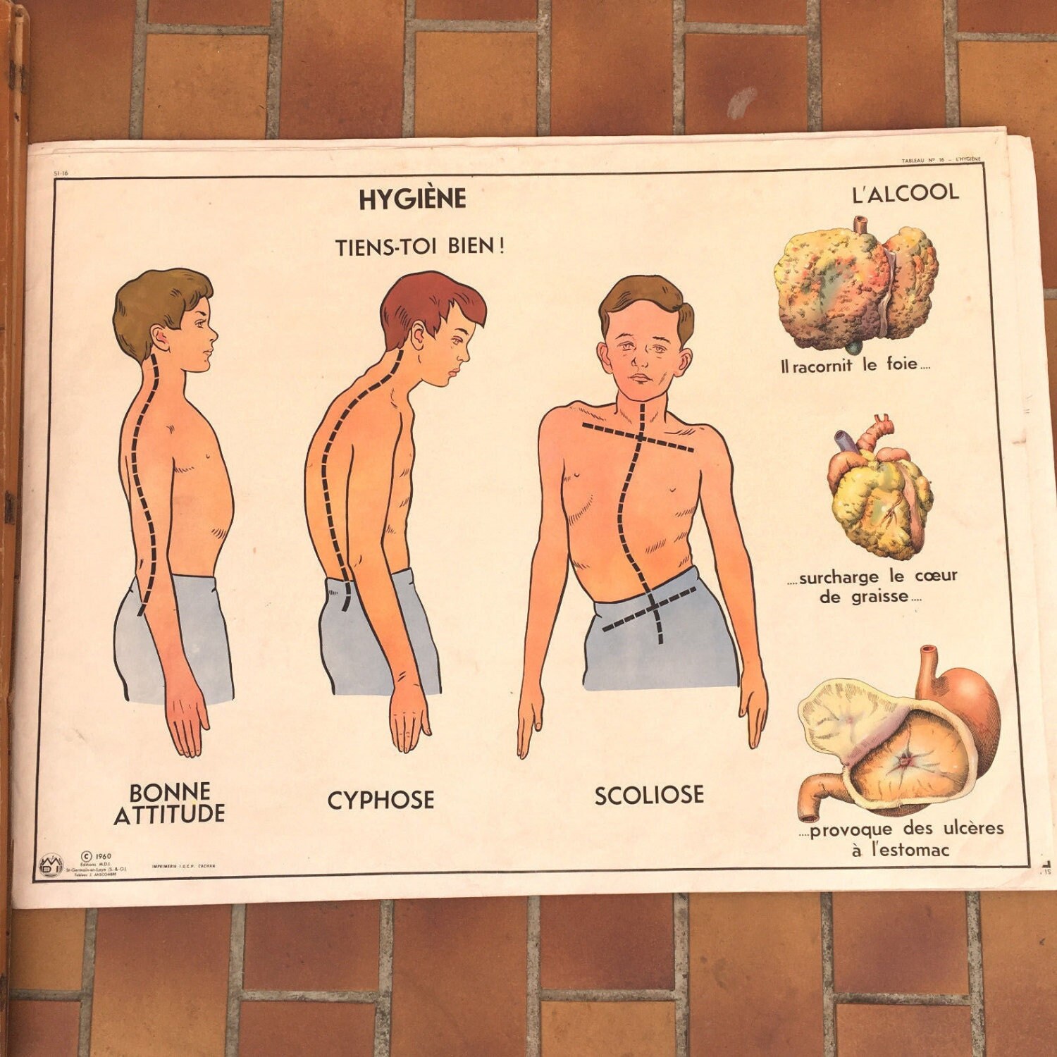 Rossignol Mdi Vintage Français École Affiche Anatomie Deux Faces Années 1960 20