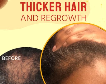 Aceite para el crecimiento del cabello Glammed Naturally: 100 % natural, cabello más grueso