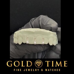 Custom Gap Bar Grillz – 3 Gap Bar Gold or Silver Grillz | Made to Order Grillz with Free Impression Kit | Available in 10k, 14k, or Plated