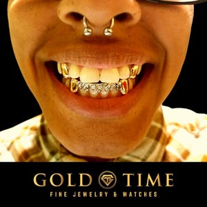 Custom Grillz Two-Tone Diamond-Cut with Solid Canines and Trillion-Cut Drip Design – Silver, 10k or 14k Gold – Luxury  Teeth Jewelry
