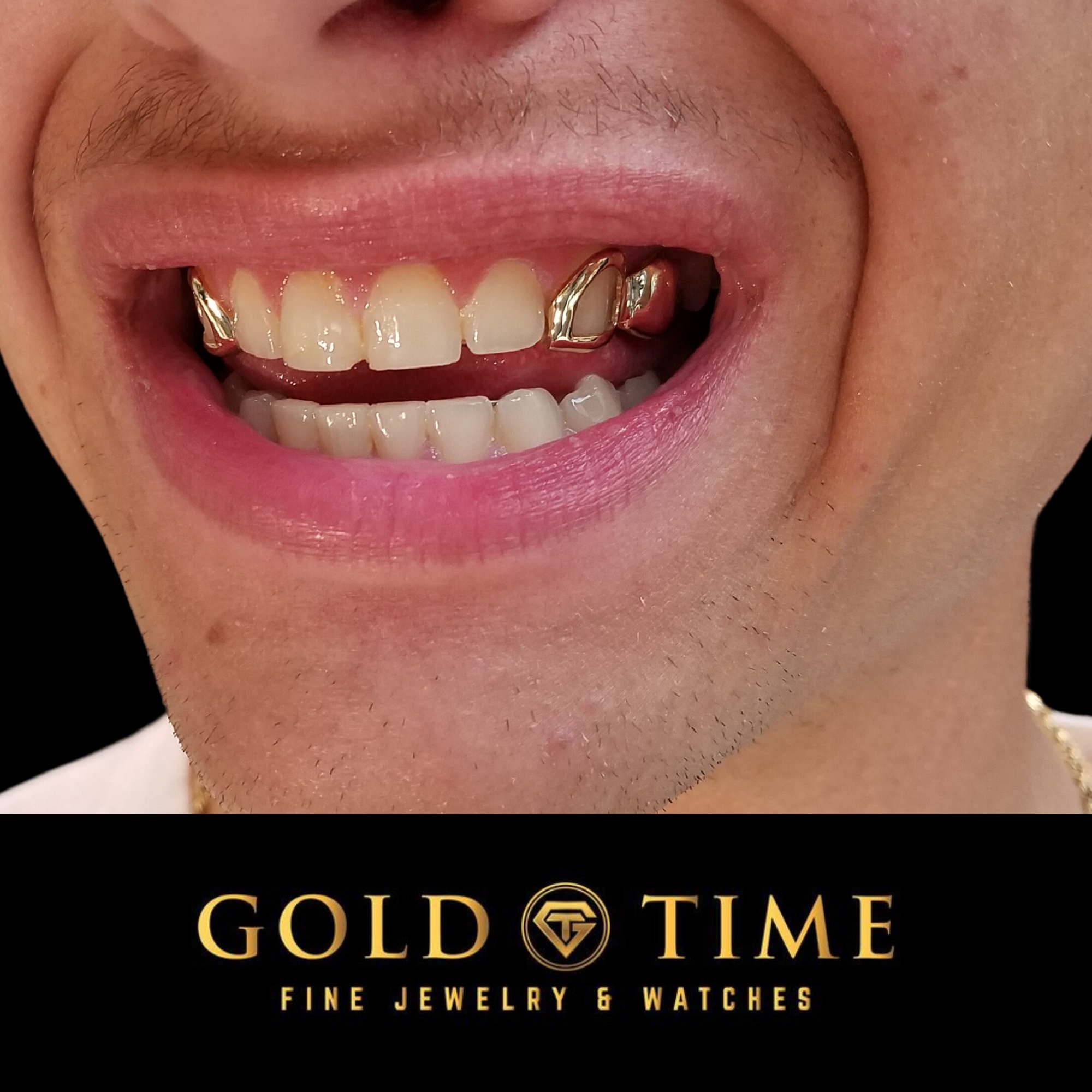 Vergoldete Grillz Eckzähne - Doppelkappe Gold Zähne Für Party & Events, Einfache Montage Mit Formstab