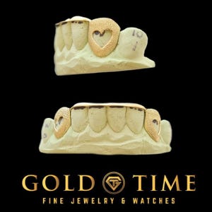 Custom 6-Piece Diamond Dust Grillz with Heart Cut Out Canines & Center Tips | Handmade Gold or Silver Teeth | Personalized Grillz