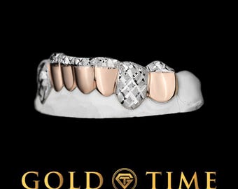 Grillz bicolore personalizzati – Design Trillion Diamond-Dust da 8 pezzi