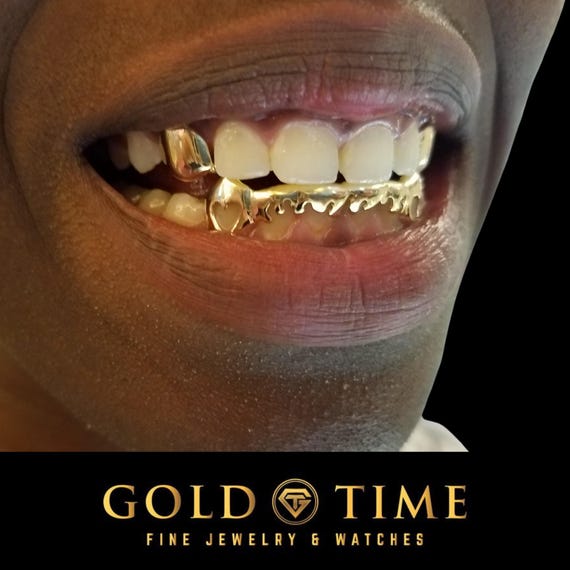 Custom Gold Drip Grillz With Heart Cutout Canines – Piece