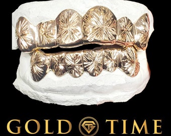 Handgefertigtes Starburst Grillz Set: Custom Fit, Silber oder Gold, inklusive Mold Kit