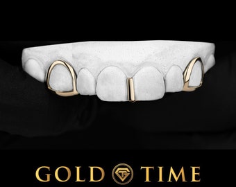 Custom 3-Piece Gold Grillz with Open Face Canines & Gap Bar