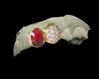 Custom 2-Piece Grillz with Custom Color & Honeycomb Moissanite