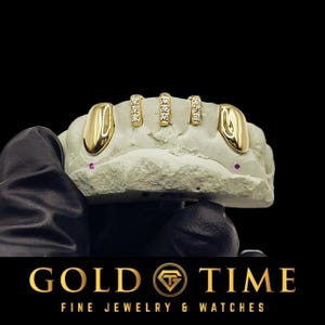 5-Piece Custom Grillz with Solid Canines & CZ Gap Bars – Gold, Silver, or Rose – Personalized Fit – Includes Impression Kit