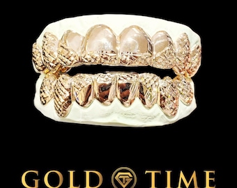 Puede incluir: Juego de grillz personalizados de color dorado sobre un molde blanco, con un diseño texturizado. Los grillz se muestran sobre un fondo negro, con las palabras "GOLD TIME" y "FINE JEWELRY & WATCHES" en letras doradas.