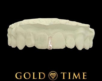 Anpassad Single Gap Grillz: Guld- eller silverfärgad tandstång med gjutformskit
