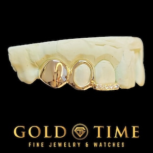 Op maat gemaakte 3-delige massieve, open moissaniet-tipgrillz – inclusief malkit