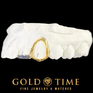 Puede incluir: Una rejilla dental chapada en oro con un acento con incrustaciones de diamantes, exhibida en un molde dental blanco. La rejilla es de color dorado brillante y tiene un acabado liso y pulido. El texto "GOLD TIME FINE JEWELRY & WATCHES" está en la parte inferior.