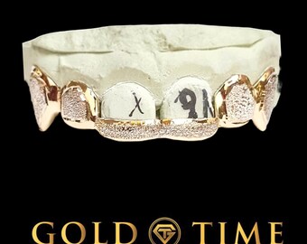 Custom 6-Piece Diamond-Dust Grillz – Solid Gold or Silver, Canine Fangs