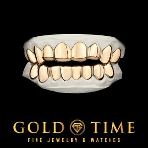 Custom Gold Grillz Top & Bottom Set – Solid Gold Design, 12 to 20 Teeth Options, Handmade and Fully Custom, Includes Impression Kit